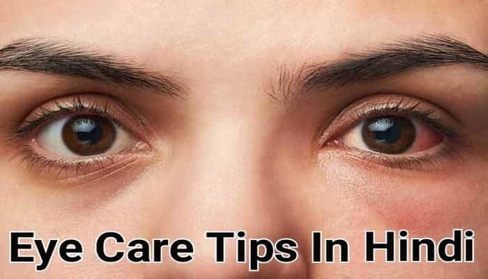 Eye Care Tips In Hindi | आंखों की देखभाल के तरीके हिंदी में